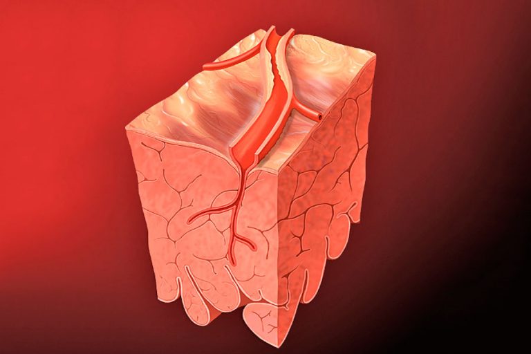 What is Cholesterol?